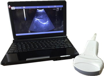 Mobile diagnostic Digital Laptop Ultrasound Scanner  B /  W 10.1 inch LED Display with Convex Transvaginal Linear probes