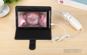 Vaginal Digital Electronic Colposcope AV  USB Output For Feminine Hygiene to See Cervix