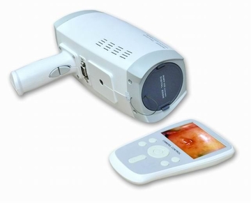 Digital Hand Held Camera Colposcope for Gynecology to See Cervix
