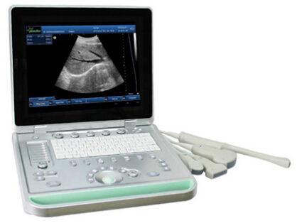 3D Digital Laptop Portable Ultrasound Scanner With Convex Probe Transvaginal Linear Probe