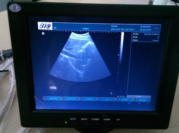 3D Digital Laptop Portable Ultrasound Scanner With Convex Probe Transvaginal Linear Probe