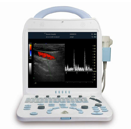 Color Doppler Portable Ultrasound Scanner For Cardiology Measurement