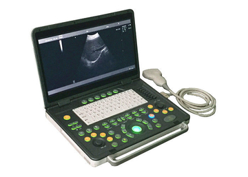 15 inch Notebook Diagnostic Ultrasonic Device Convex Probe Scans Abdomen Liver Kidney